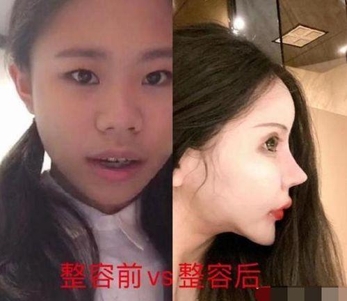 男网红整容脸吃瓜视频,吃瓜群众热议的整形真相  第3张